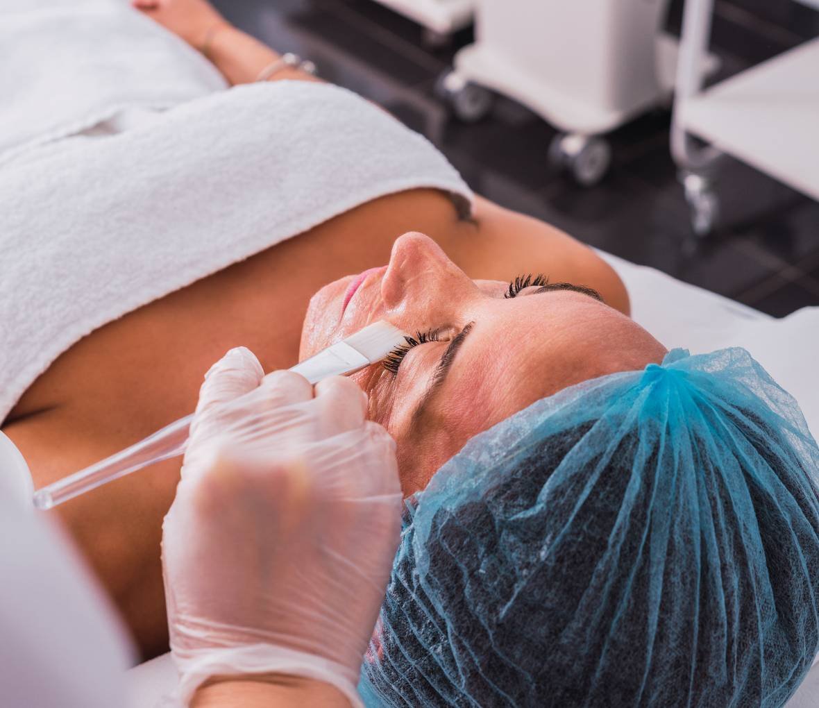 Expert Chemical peels treatment in Bangalore at Aurilueur clinic