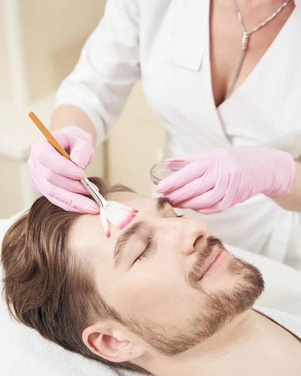 Glycolic acid peel treatment in Bangalore at Aurilueur Clinic