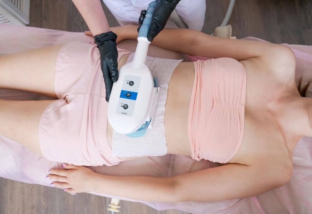 Cryolipolysis Treatment in Bangalore using fat-freezing technology.