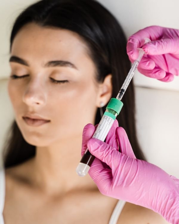 PRFM Hair Regrowth Treatment in Bangalore for hair loss