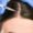 Safe and non-invasive stem cell regrowth treatment for natural hair restoration in Bangalore at Aurilueur.