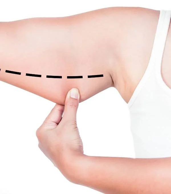 Best Coolsculpting in Bangalore