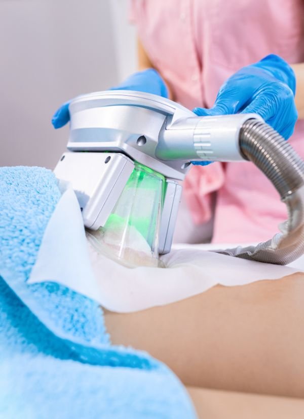 How Coolsculpting work