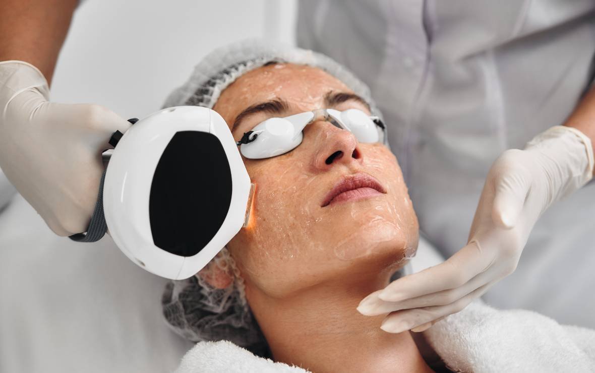 Pigmentation treatment in Bangalore at Aurilueur clinic