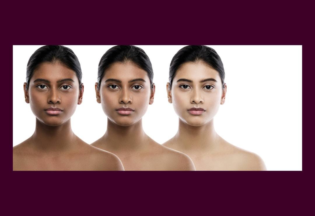 Full Body Whitening Treatment in Bangalore at Aurilueur clinic