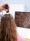 Hair Transplant Clinic in Bangalore offering scalp diagnosis at Aurilueur