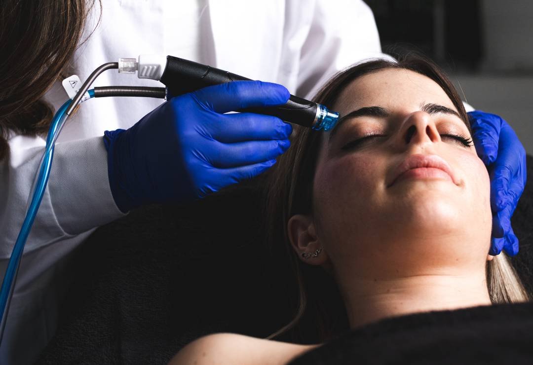 Hydrafacial treatment in Bangalore at Aurilueur clinic
