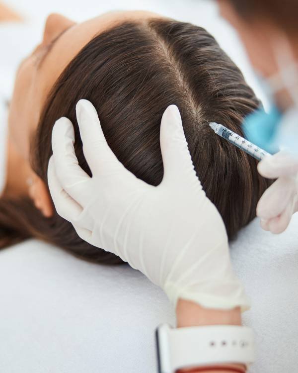 Real before-and-after GFC hair treatment in Bangalore results across 5 months from Aurilueur patients.
