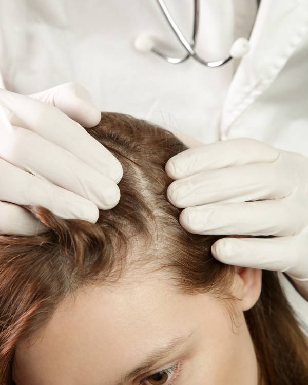 Mesenchymal stem cell hair restoration at Aurilueur esthetic clinic