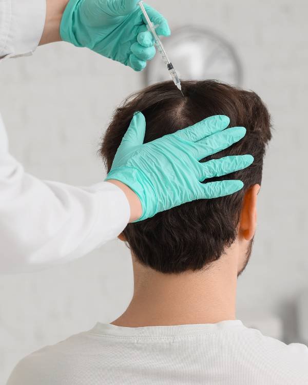 PRFM hair treatment in Bangalore at Aurilueur esthetic clinic