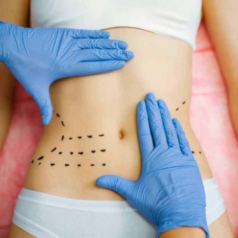 Aurilueur physician discussing CoolSculpting cost in Bangalore with patient during free consultation