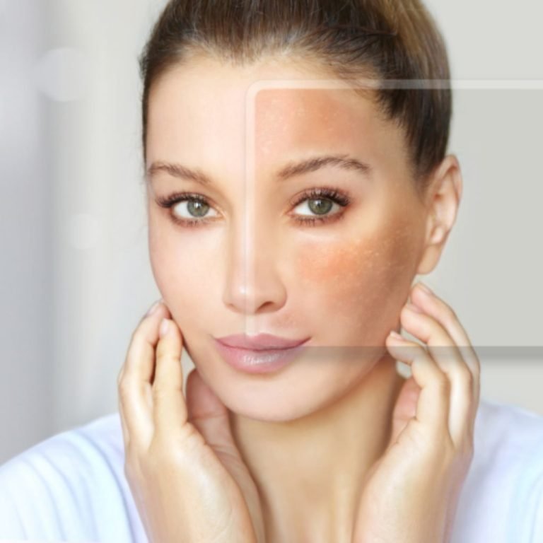 How to Prevent Sun Damage. Skin care with Aurilueur