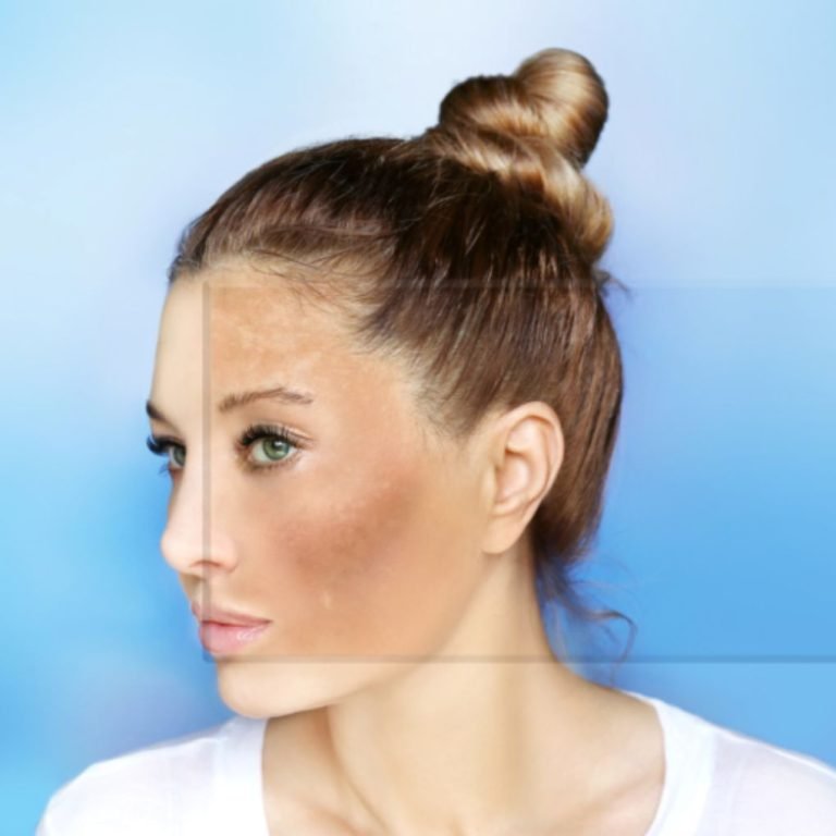 How to Repair the Sun Damage Skin at Aurilueur