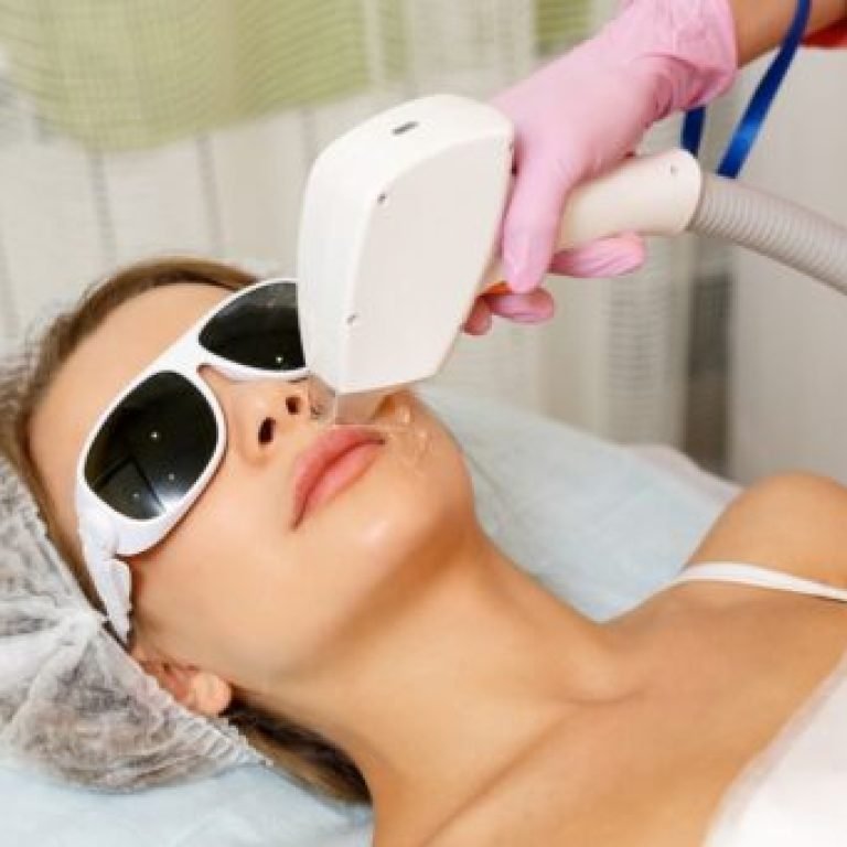 Expert performing laser hair removal cost in bangalore session on client’s skin.