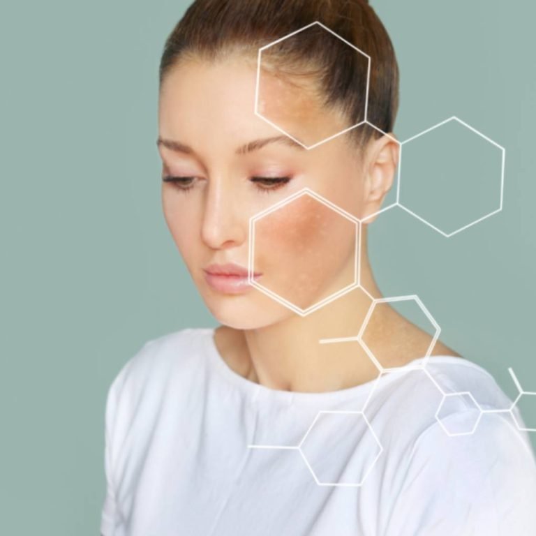 Sun Damaged Skin Treatment to restore skin's natural glow.
