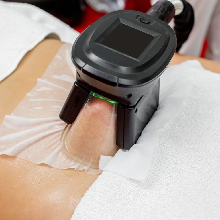 CoolSculpting reduce belly fat at Aurilueur