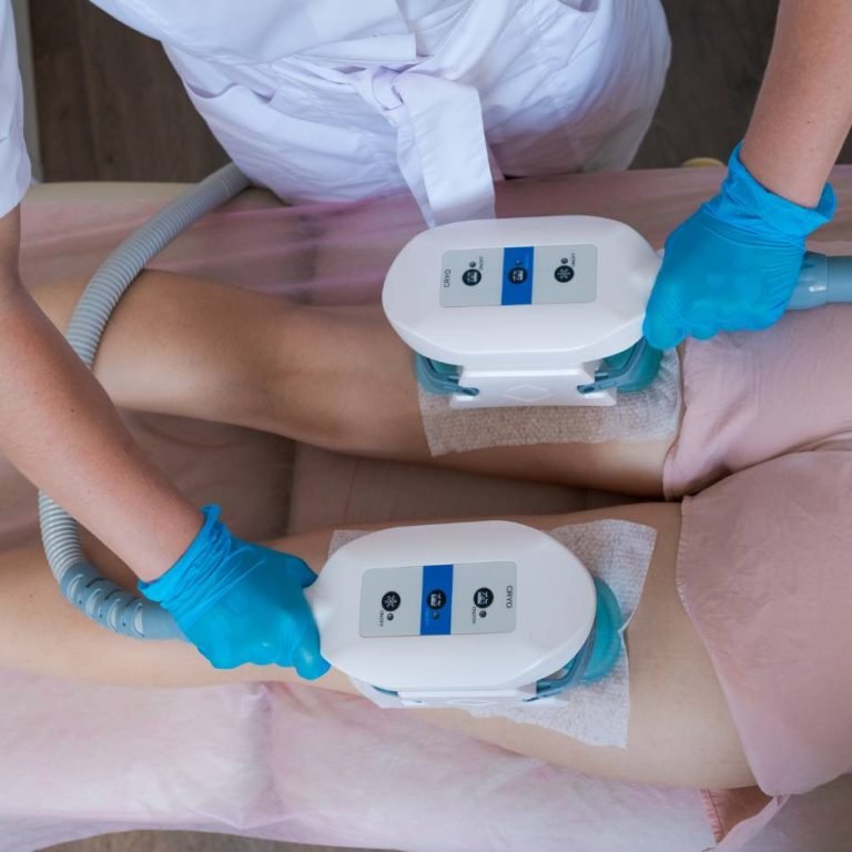 fat freezing procedure walkthrough at Aurilueur Indiranagar