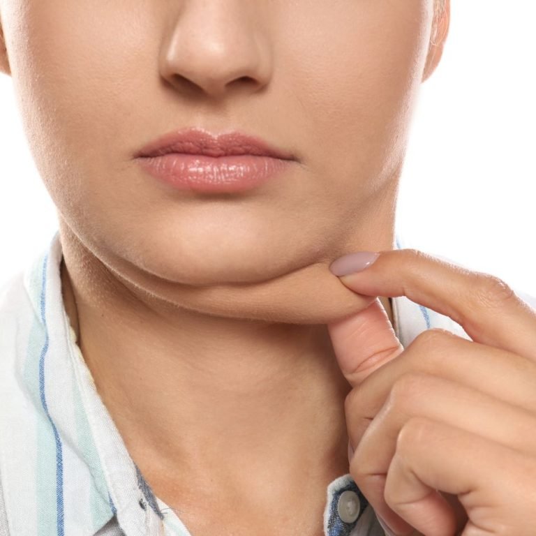 how to remove double chin without surgery