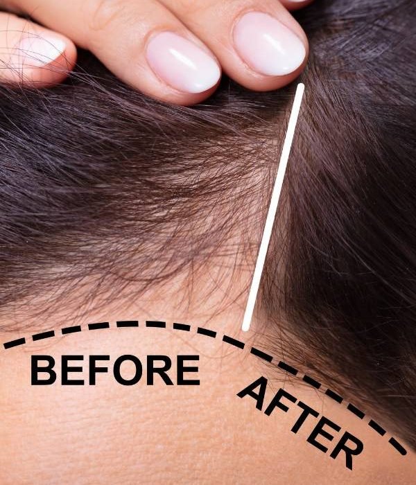 PRP vs GFC hair treatment comparison at Aurilueur esthetic clinic