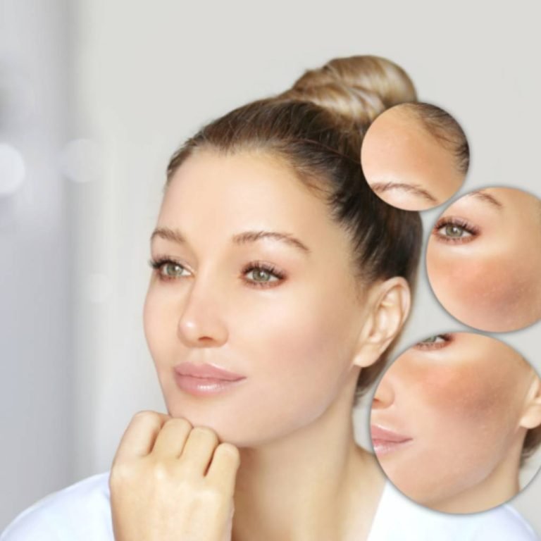 Sun damaged face skin treatment for a rejuvenated face at Aurilueur.